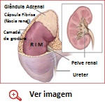 Catecolaminas-Glandula Adrenal